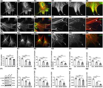 Decreased tubulin-binding cofactor B was involved in the formation disorder of nascent astrocyte processes by regulating microtubule plus-end growth through binding with end-binding proteins 1 and 3 after chronic alcohol exposure